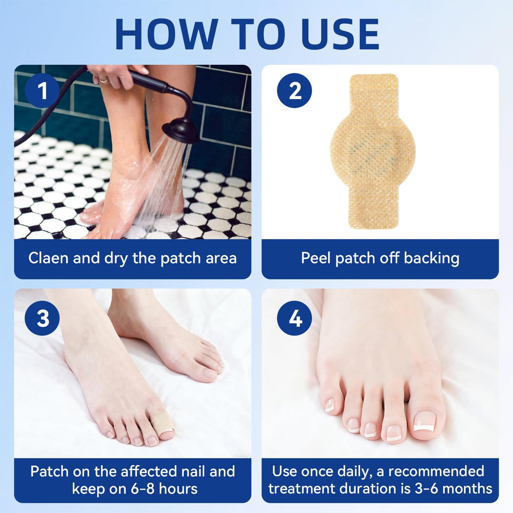 JoyJar 21-patch pack supports ongoing nail restoration efforts.