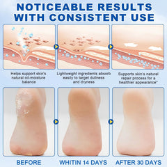 JWBVCTCR portable design enables precise application on feet.