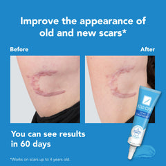 KELO-COTE gel-itch-relief-discomfort-scar-care highlights itching relief.