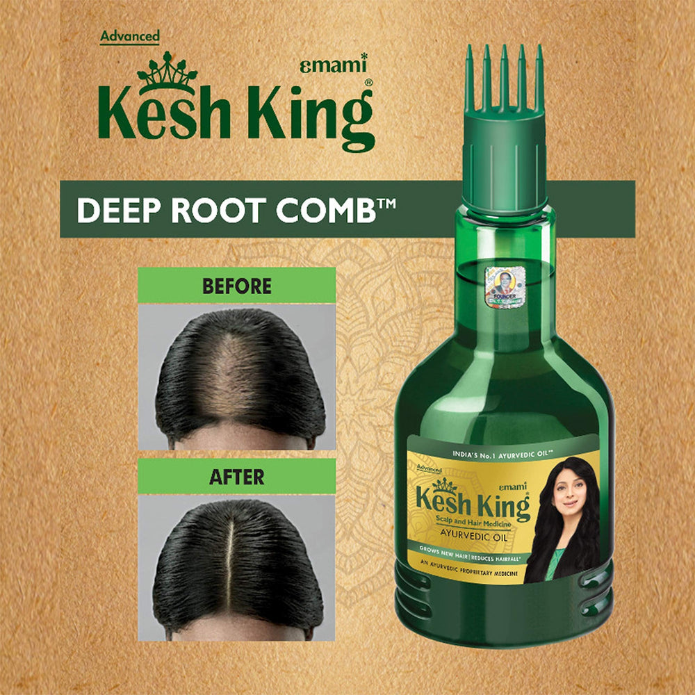 Graphic showing hair growth with Kesh King