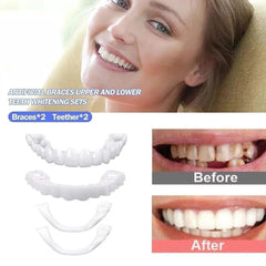 Lightweight and comfortable temporary smile kit