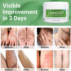 LMNOOP Eczema Therapy bottle demonstrates convenient squeeze for targeted care.