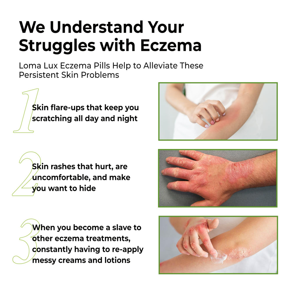 Loma Lux Eczema Pills label close-up showing vegan and gluten-free claims.