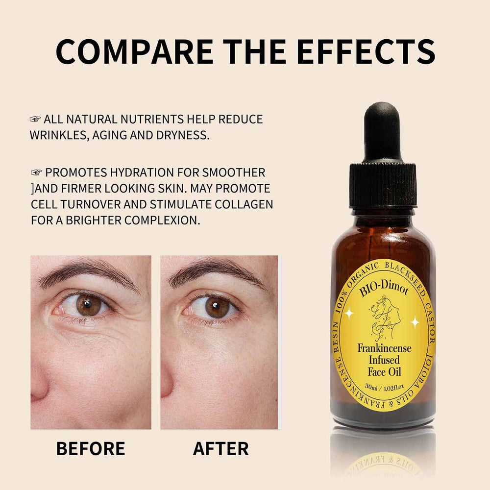 LOYOTICE Frankincense Resin Oil silky texture on hand for fast absorption
