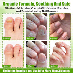 LSROUMEL Twist Pen in action supports gentle daily nail care.