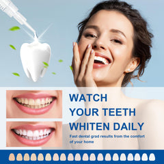 Stain removal with whitening gel – before and after