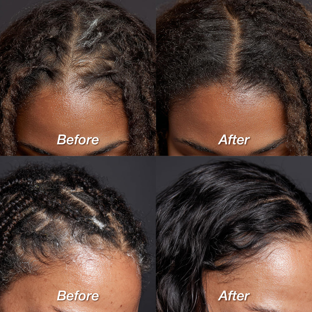 Lux Collection Detox Powder being applied to scalp on braids