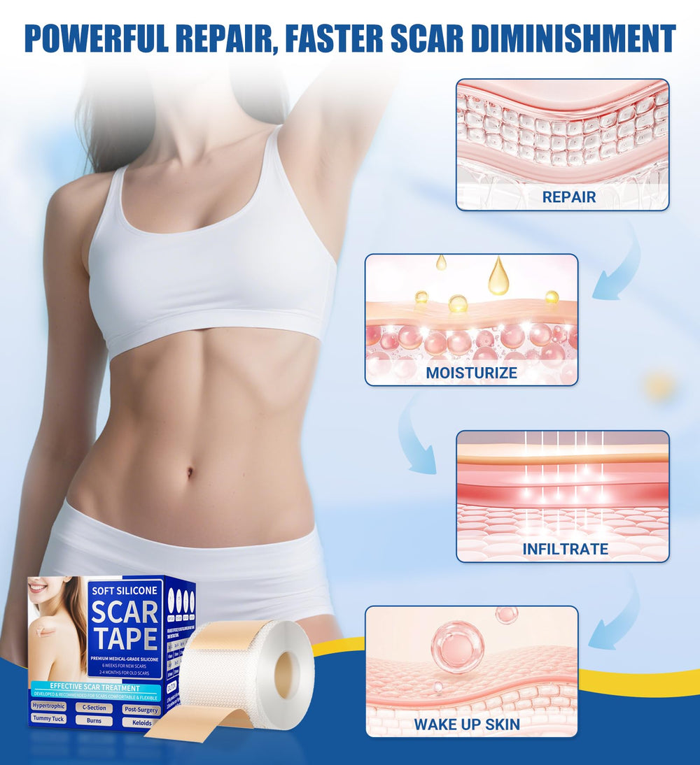 MasterMo pre-cut scar tape shapes fit varied scar contours easily.
