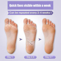 Mckkymi lavender packaging for foot peel mask 5 pack