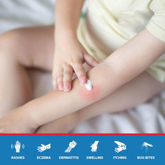 MED PRIDE 1% Hydrocortisone Cream on skin in use to calm irritation