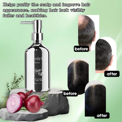 Medyi Onion Rosemary Shampoo pump bottle shown for easy daily dispensing.