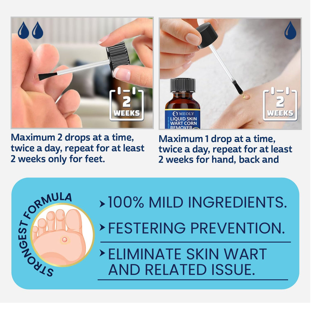MEOLY wart remover box and tube on clean surface.