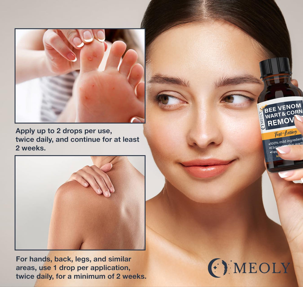 MEOLY Bee Venom Wart Remover designed for genital wart safe-use guidance.