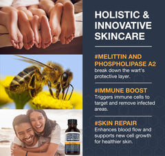 MEOLY Wart Remover for plantar wart treatment on feet with fast-acting formula.