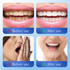 Hydroxyapatite powder removes teeth stains