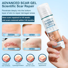 Mitgary Advanced Scar Gel on the face highlights gentle scar care.