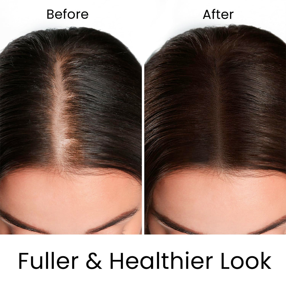 MOEHAIR Rosemary extract spotlight emphasizing scalp health.