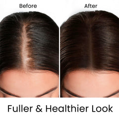 MOEHAIR Rosemary extract spotlight emphasizing scalp health.