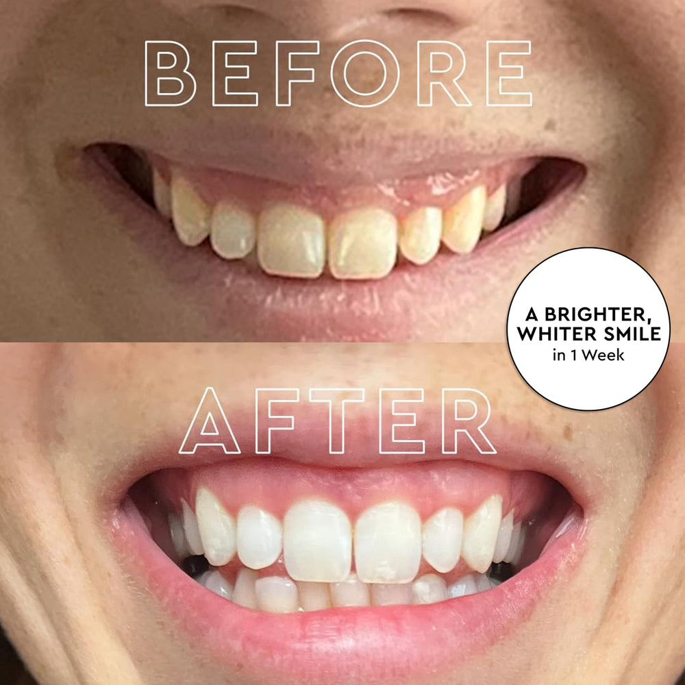 Cordless MOON LED whitening light device