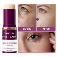 MOONGAZE Calcium Multi-Balm Stick for lips and surrounding area hydration