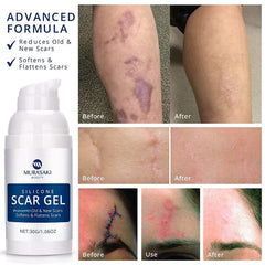 MURASAKI BEAUTY scar gel hand-massage demonstrates gentle application for scar care