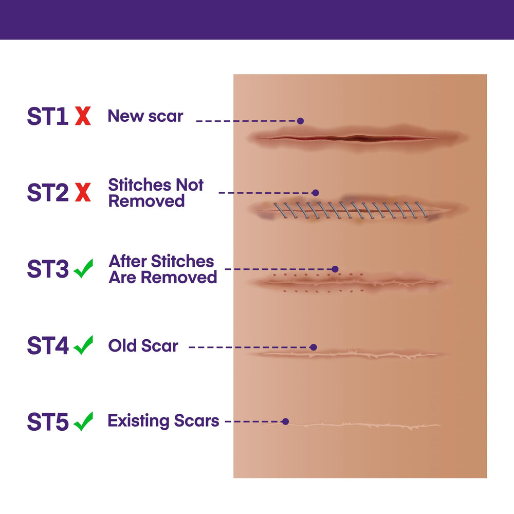 MURASAKI BEAUTY scar gel on skin near healing area.