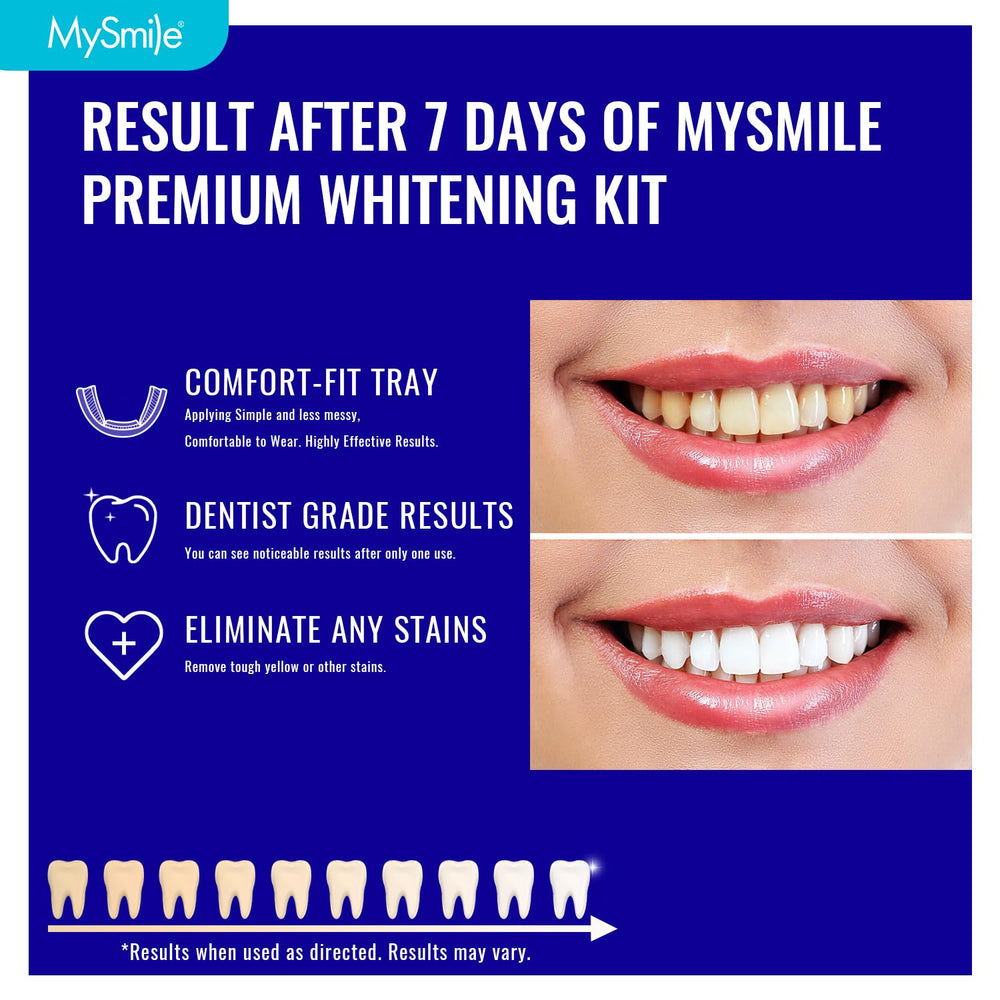 12% hydrogen peroxide whitening gel inside the MySmile kit