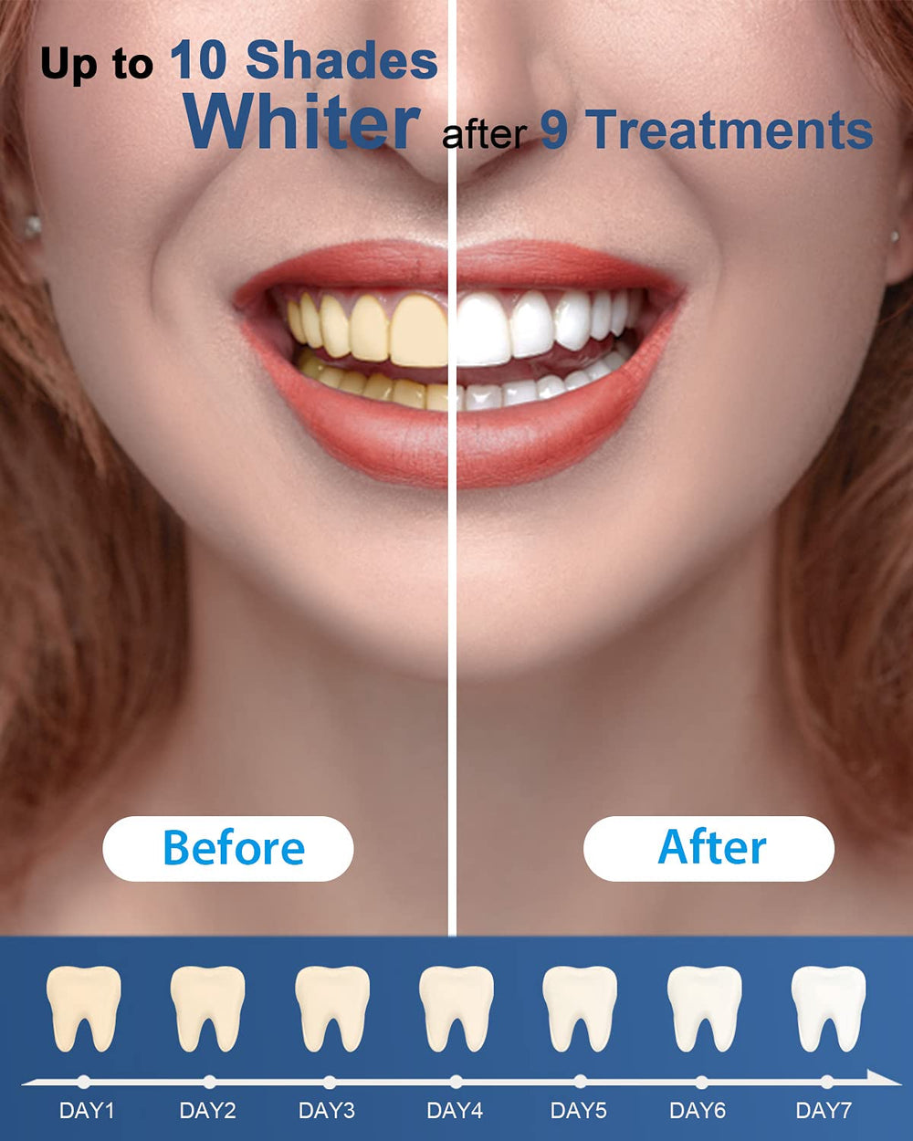 Package of MySmile refills with gel pens and tray