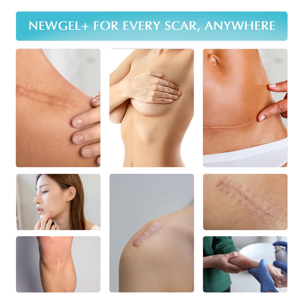 MyNewGel Plus after-use dry finish—skin ready for daily cosmetics.