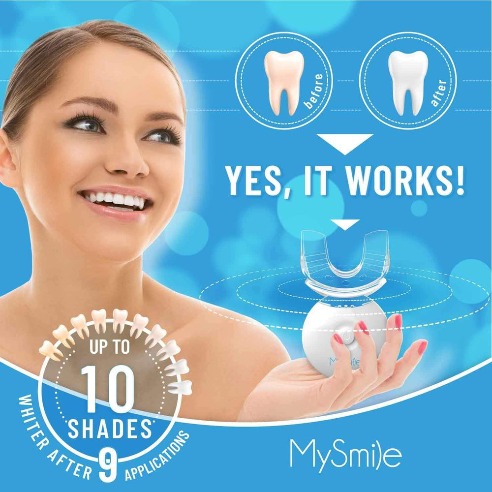 At-home professional-grade teeth whitening with MySmile