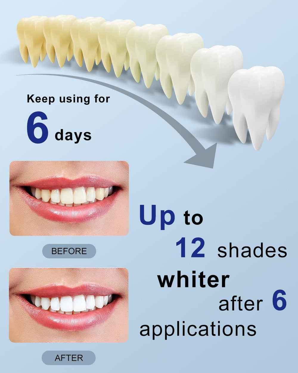Before and after whitening results with MySmile