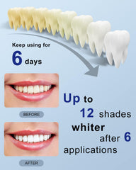 Before and after whitening results with MySmile