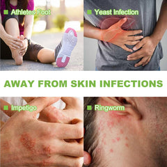 Natouch antifungal medicated soap bar anti-fungal action highlights ringworm and athlete's foot care.