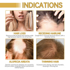 Before and after look with Natural Rosemary Hair Growth Oil