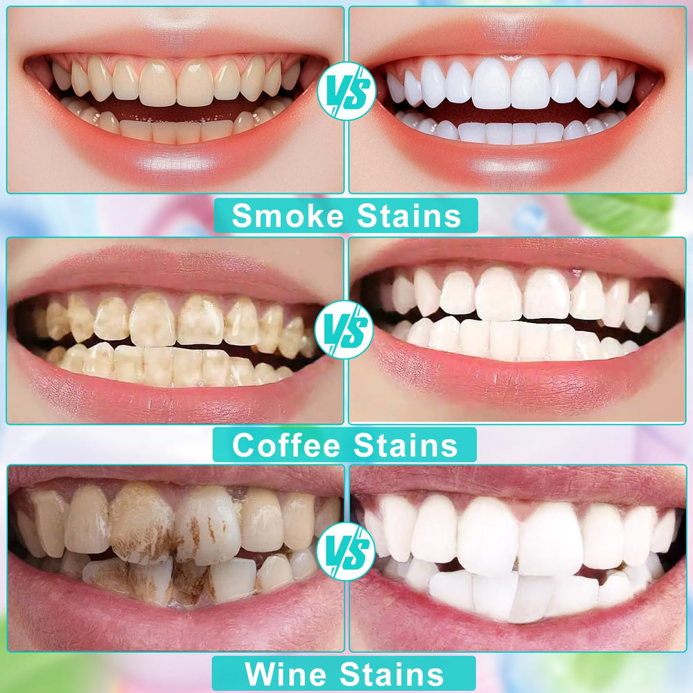 Tooth enamel with protective layer being formed