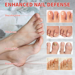 Nighttime Nail Patches hygienic-adhesion keeps patches in place during wear.