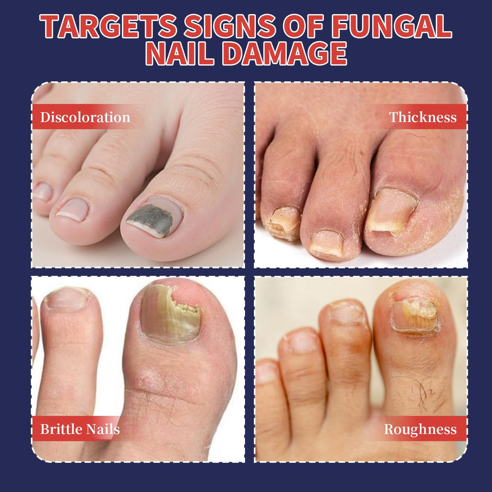 Nighttime Nail Patches hypoallergenic-formula provides gentle support for sensitive nails.
