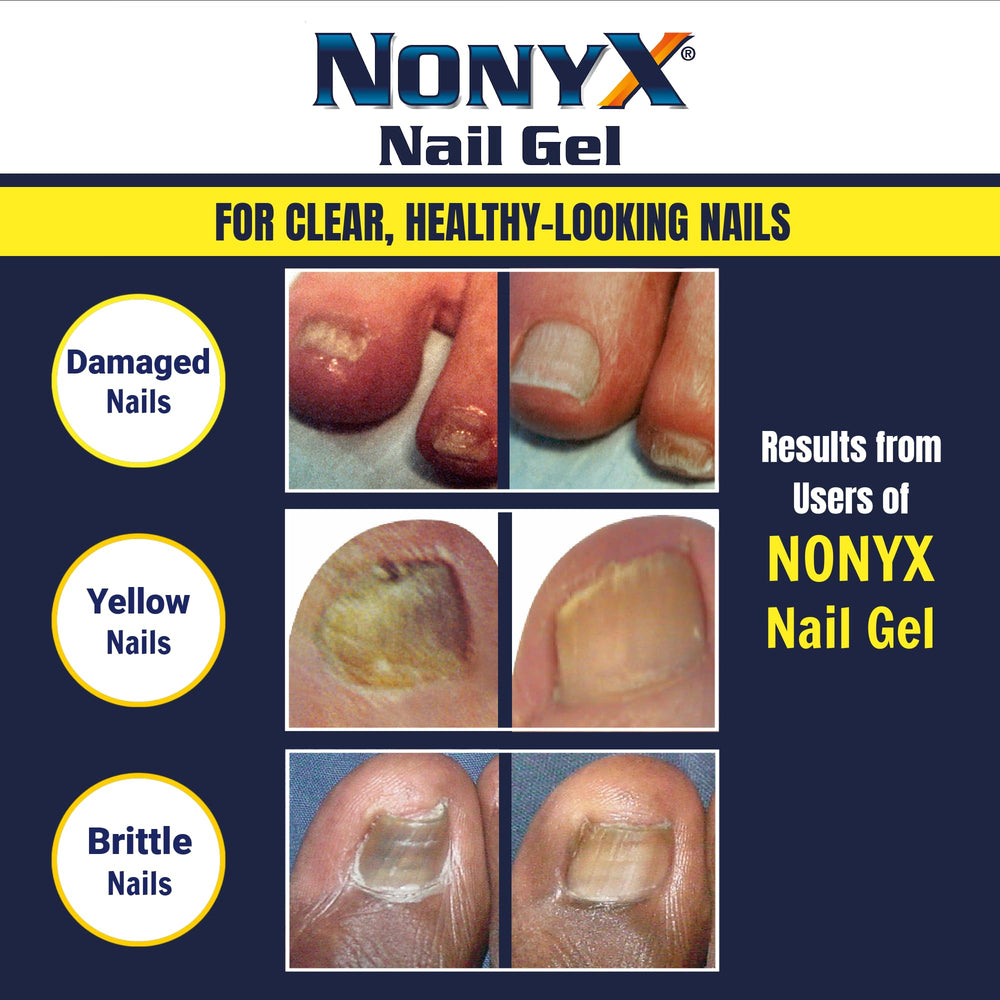 NONYX Fungal Nail Clarifying Gel made in USA label signals quality manufacturing.