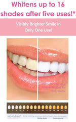 Blue LED whitening light from the Novashine kit