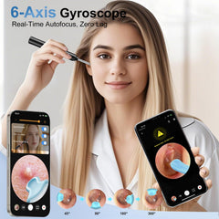 Ntgiso Traditional Ear Scoop Kit connects smoothly with the camera kit.