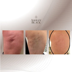 Nugget used on back or shoulder areas for deep tissue massage