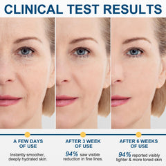 NUOYANG Retinol Firming Serum Stick chest view highlights chest hydration.