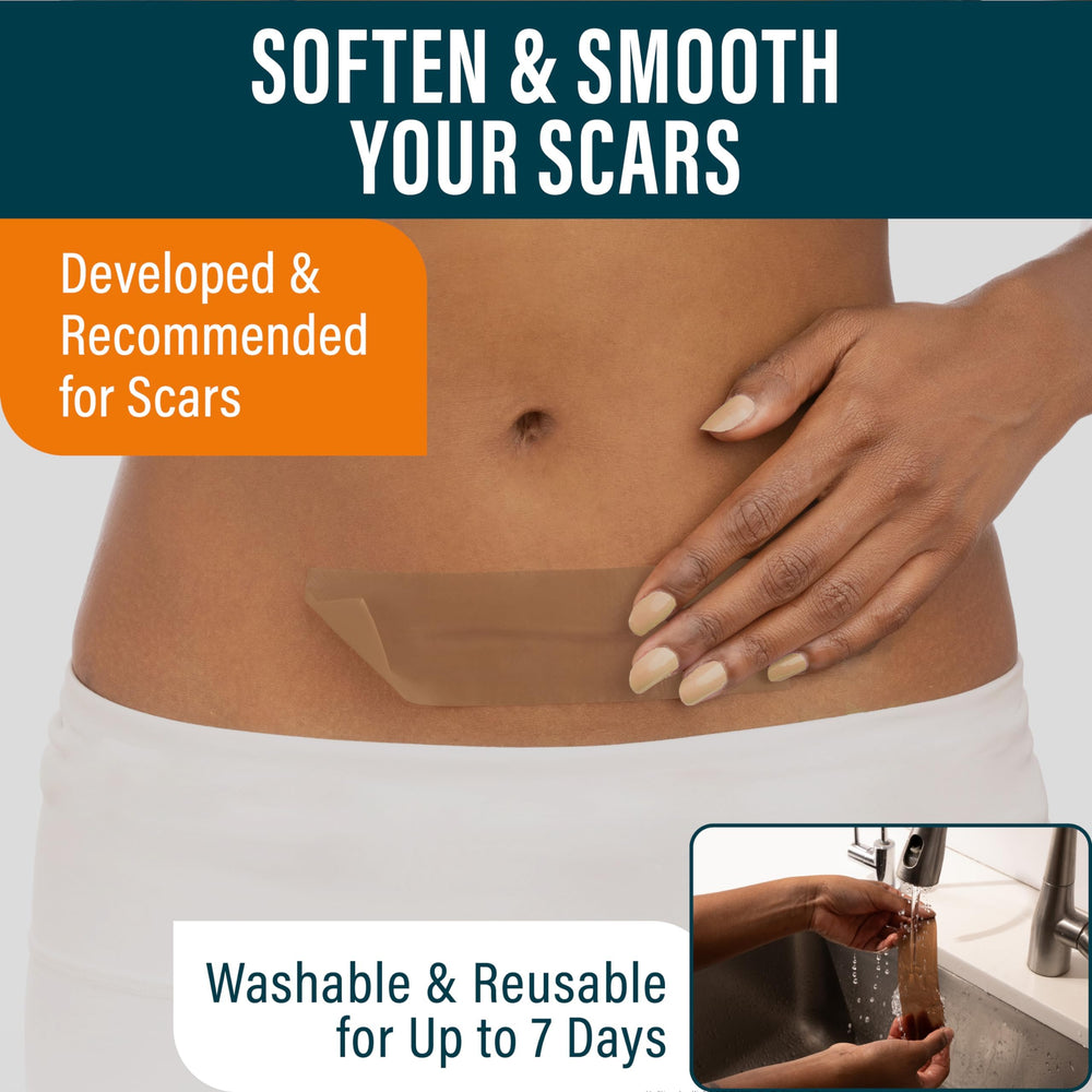 NUVADERMIS scar-tape-roll for large-area scar coverage.