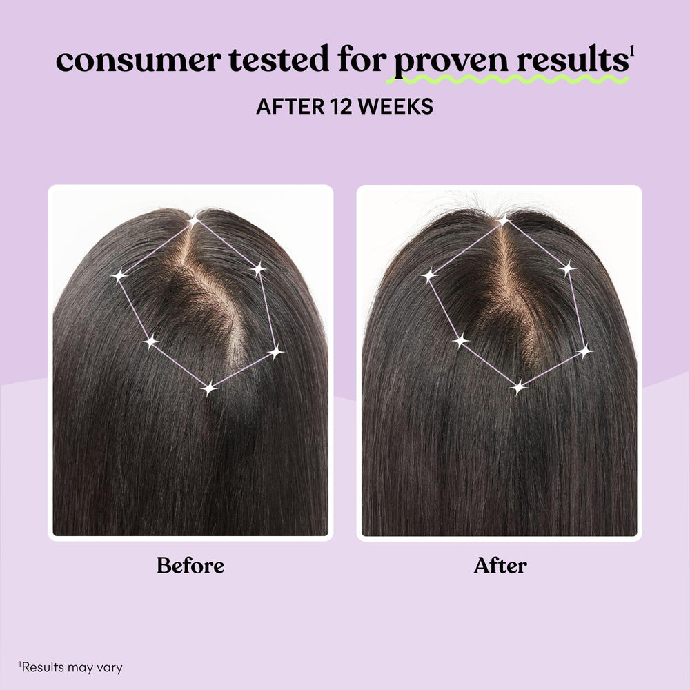 One-month supply bottle of Lemme Grow Hair Growth Supplement