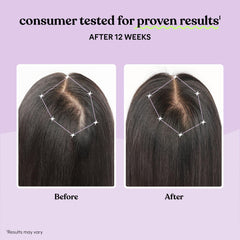 One-month supply bottle of Lemme Grow Hair Growth Supplement