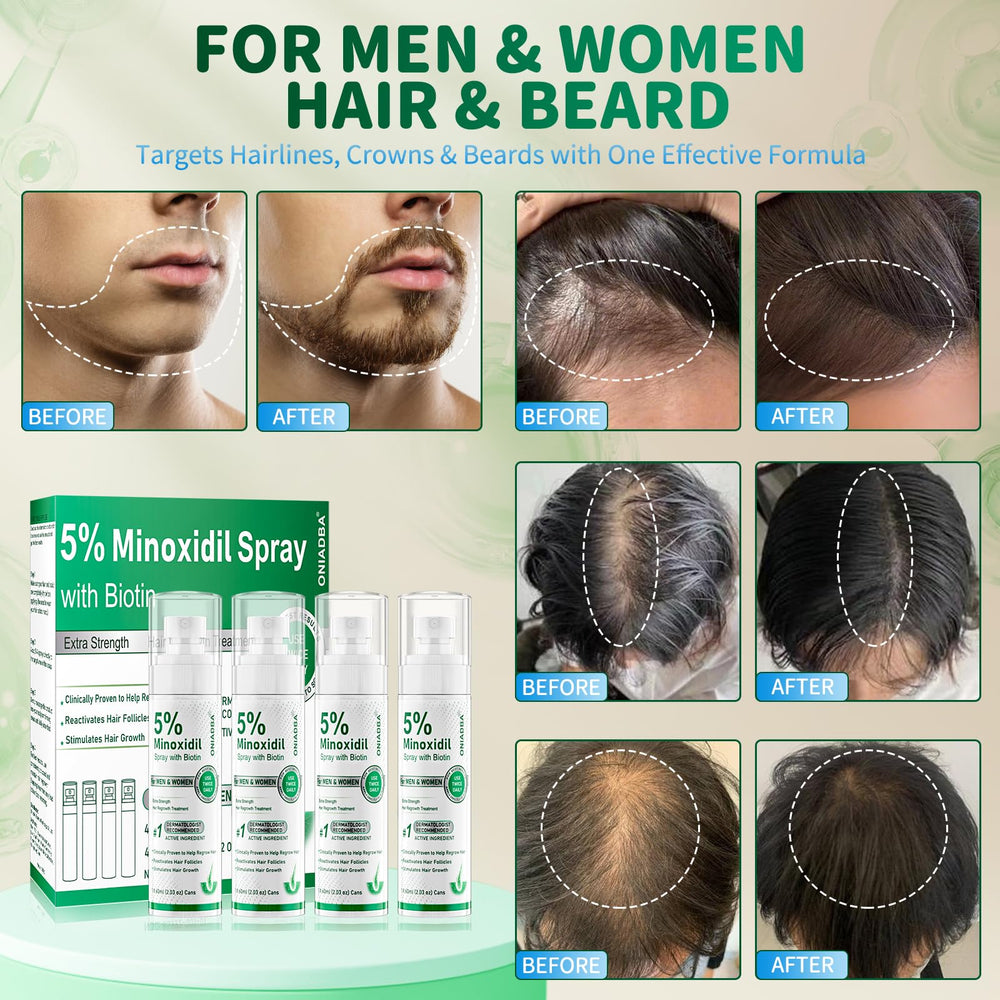 ONIADBA beard growth application targets facial hair for a fuller look.