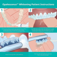 No LED light required Opalescence whitening gel