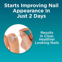 Opti-Nail skin around nail care image demonstrates protective benefits for surrounding skin.