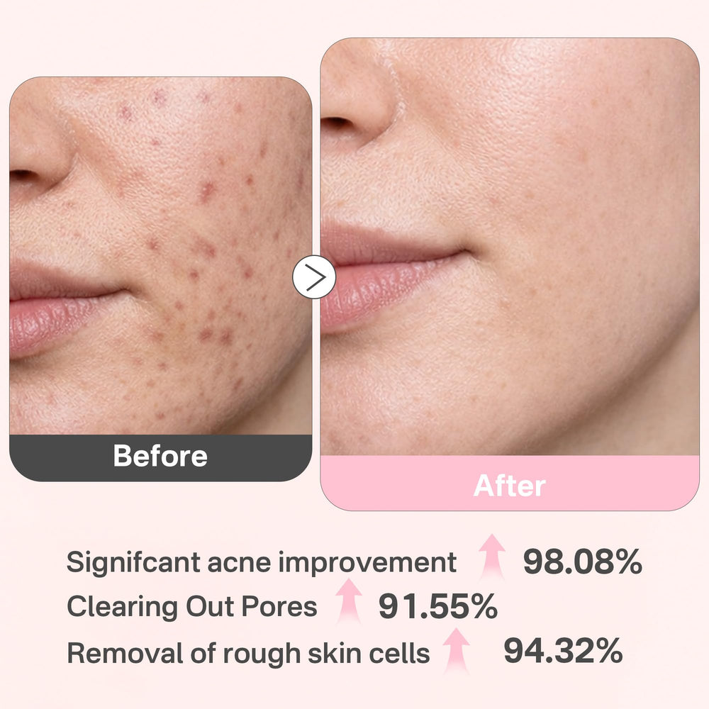 Originbuty hyaluronic-acid-infused pad emphasizes post-exfoliation hydration and soft skin