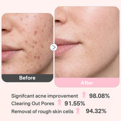 Originbuty hyaluronic-acid-infused pad emphasizes post-exfoliation hydration and soft skin